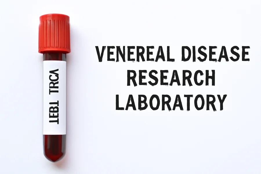 VDRL Test Full Form and Its Role in Diagnosing Syphilis